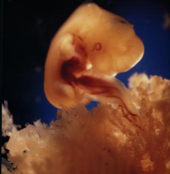 6 неделя беременности. Развитие эмбриона
